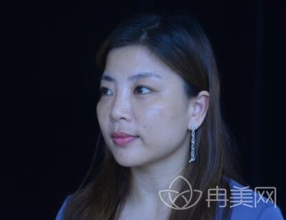 刘伟忠_个人主页_附瘦脸案例_冉美整形网