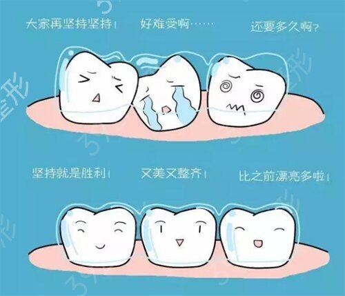 海南中西医结合医院整形外科牙齿矫正案例：