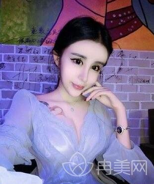 【蛇精女李蒽熙又整容成迪丽热巴啦?网友直呼：又整残了】