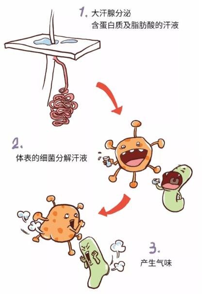 成都*腋臭研究院教你如何化解狐臭带来的尴尬