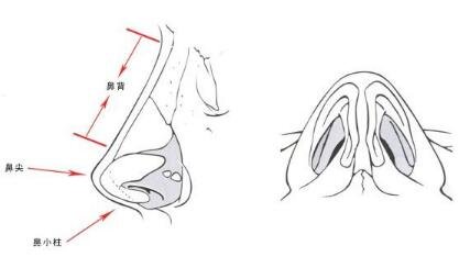 膨体隆鼻价格一般是多少？