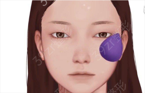 ​上海仁济医院整形外科双眼皮案例