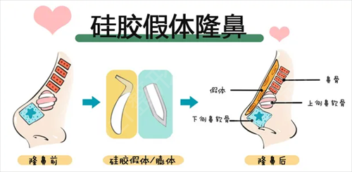 首都医科大学附属北京世纪坛医院整形美容科*案例