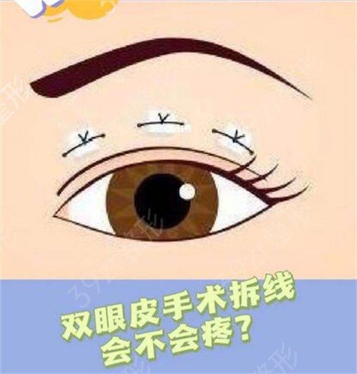 长沙雅美双眼皮怎么样?改良惺忪睡眼成就炯炯大眼