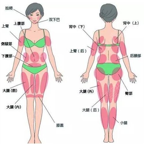 在广州星团医学美容做的全身吸脂减肥，从胖妈重回辣妈身材