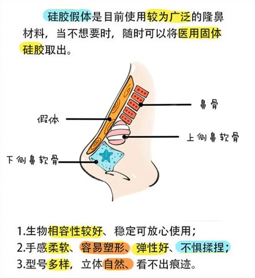 四川成都第一医院整形卿勇给我做的隆鼻【有图】