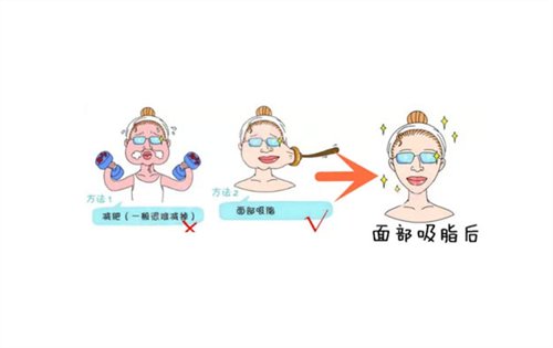 浙江省立同德医院整形外科面部吸脂+手臂吸脂案例~恢复照片