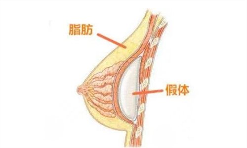 第四军医大学西京医院整形外科价格表含假体隆胸术后美图欣赏