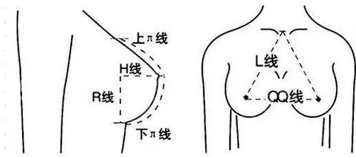 北京怡德医院整形科隆胸案例