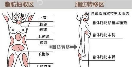 西部战区总医院整形科隆胸案例