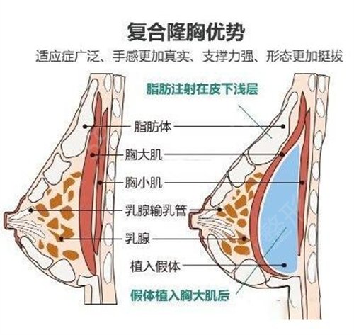 徐州市第三人民医院整形美容科整形价格一览表，附胸部整形案例