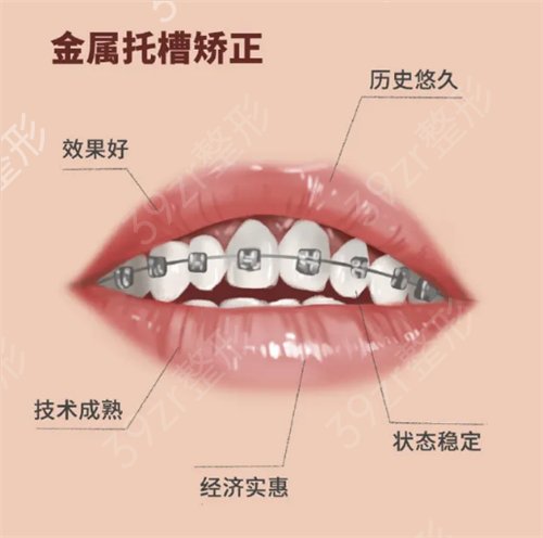 深圳鹏爱医疗美容医院牙齿矫正案例