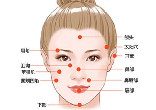 深圳芝华医疗美容医院脂肪填充案例