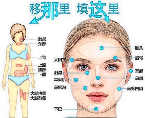 武汉莱恩整形医院价格表强势来袭，附面部填充术后*果