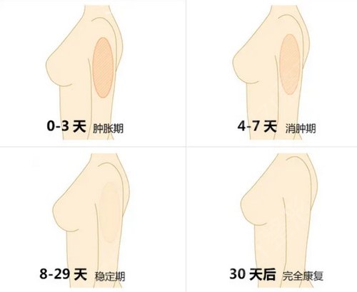 长沙时光整形价格表震撼发布，附吸脂瘦肚腩案例