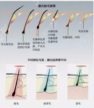 深圳第三人民医院整形外科价目表火爆来袭，附脱毛真人案例