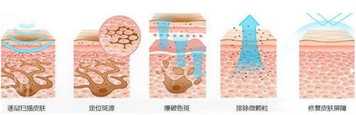 福州比华利整形医院激光祛斑案例