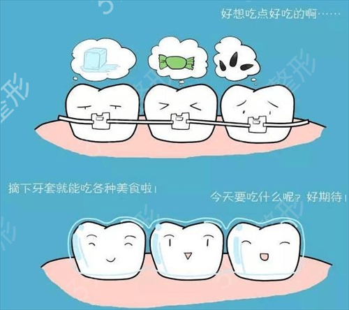 广州时光医院整形牙齿矫正案例