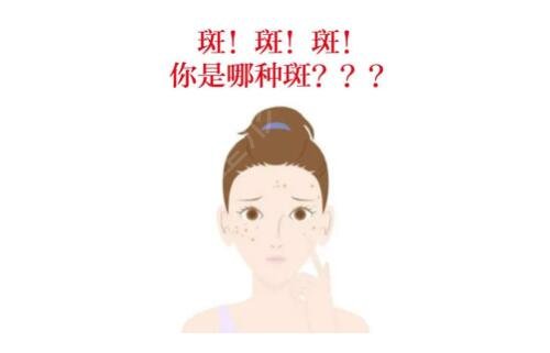 蚌埠康美整形医院激光祛斑