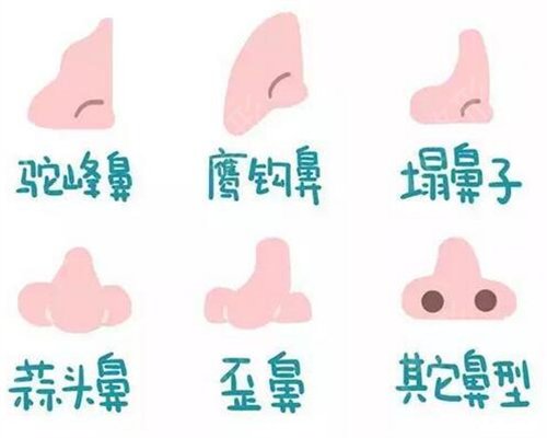 梁晓健做鼻子多少钱?怎样?分享医生个人隆鼻案例术后反馈图