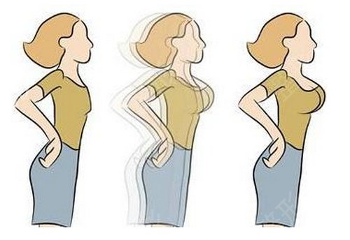 【干货】关于乳房下垂如何矫正?这四种方法你需要了解