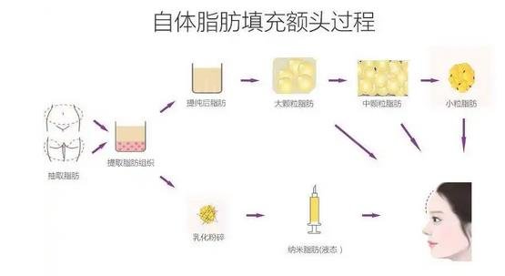 上海第九人民医院整形科面部脂肪填充*果|专家怎么样?医生?