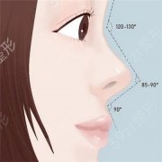 隆鼻假体取出后需要怎么护理